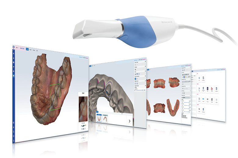 Le module Planmeca Romexis® CAD/CAM fait passer les empreintes numériques au niveau supérieur